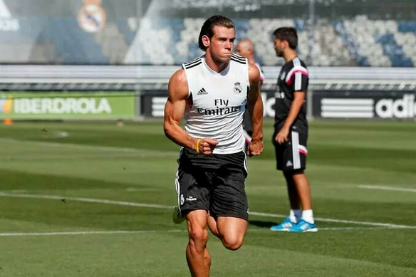 Is Gareth Bale going bald?